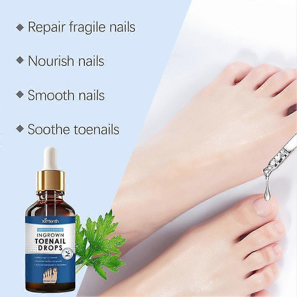 Ingrown Toenail Treatment. Ingrown Nail Repair Serum