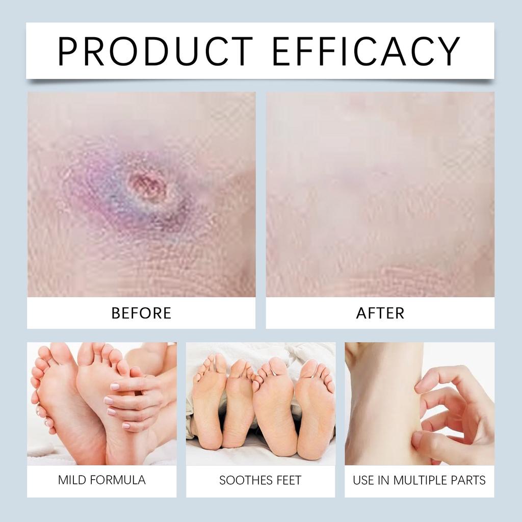 Cares For Diabetic Wounds;  Reduces Swelling And Skin Sensitivity; Relieves Foot Fatigue30ML