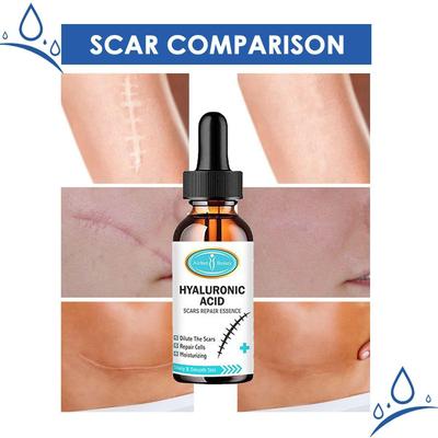 Scar Repair Essence Dilute Scar Repair Cell Moisturizing Care Fluid Nourishing, Whitening and Brightening Essence