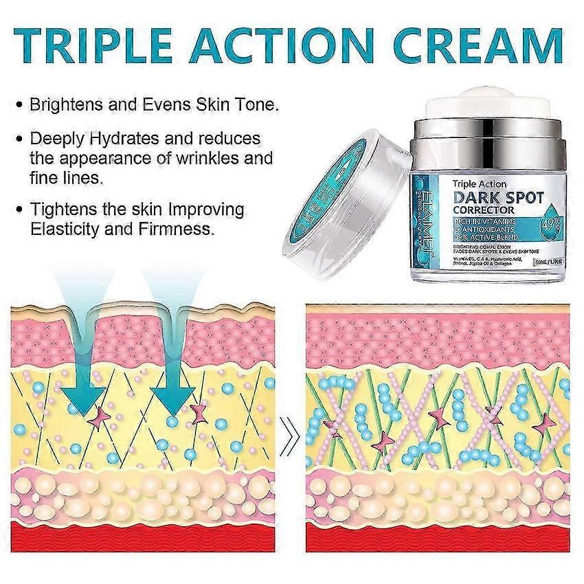 Dark Spot Corrector Cream 50ml for Face Pigmentation Freckles Chloasma Sun Spots