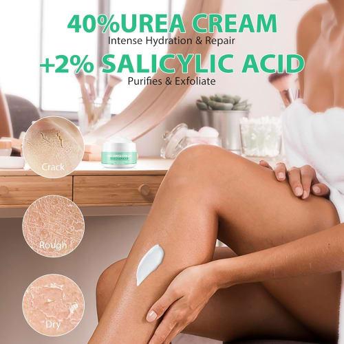 Urea Cream, Hand and Foot Hydration, 40% Urea Cream for Dry, Cracked Feet, Heels, Knees, Elbows, and Hands, Moisturizing, Corn Removal, and Calluses,