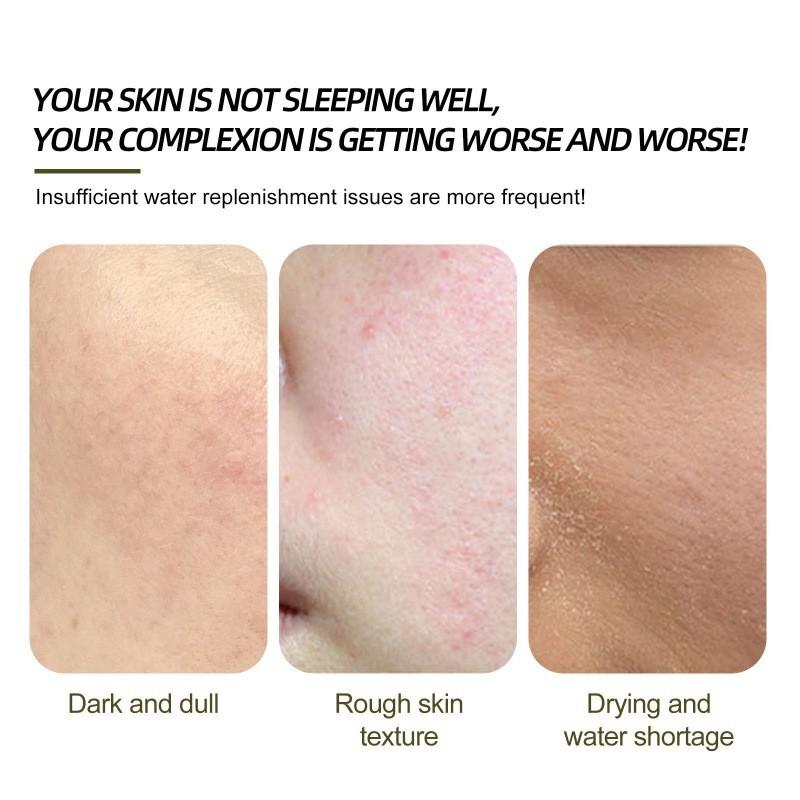 Eelhoe Clear Skin Willow Bark Essence Nourishing Moisturizer For Dry Skin And Acne Scars