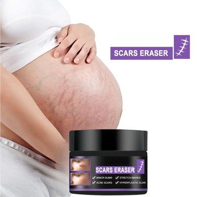 Scar Repair Cream Desalt Postoperative Scars, Smooth Skin, Repair Skin Wounds, Moisturize Skin Care Cream
