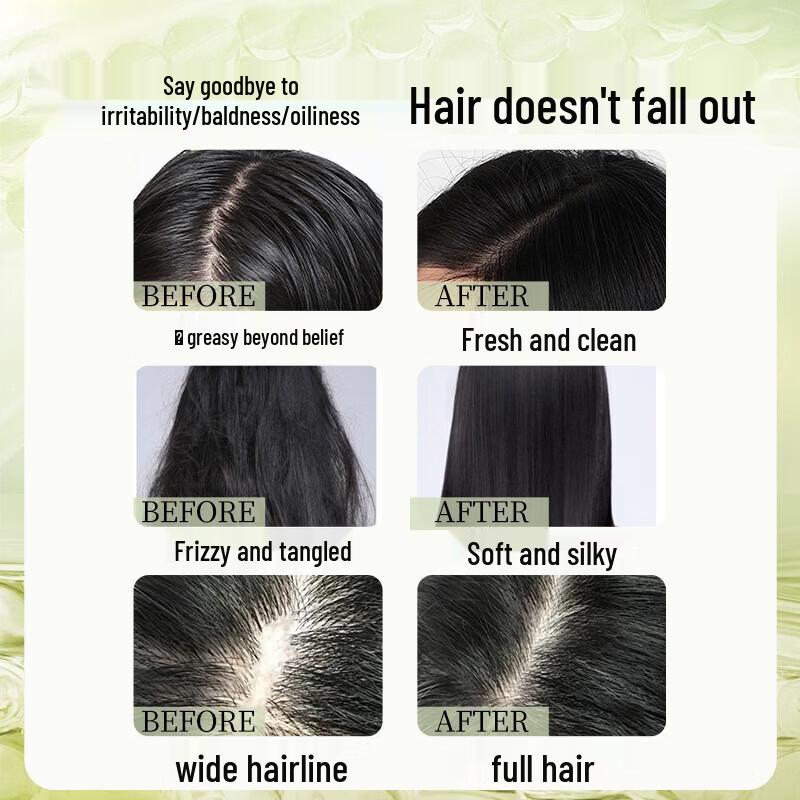 Bawang Anti-Hair Loss Volumizing Shampoo