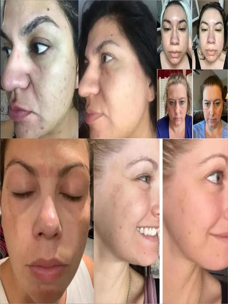 Moisturizing Face Cream, Repair Dry Skin, Protect Skin, Improve Skin Quality, Lubricate And Tighten Skin, Make Skin Delicate And Tender