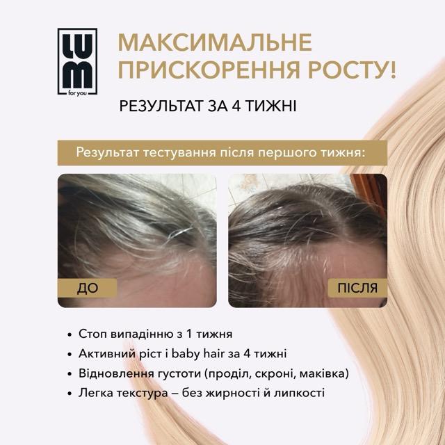 LUM kit "90-day course: follicle activation and density formation"