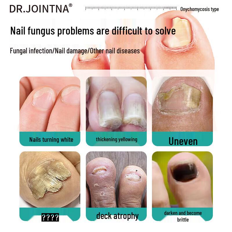 DR.JOINTNA Fungal Nail Treatment