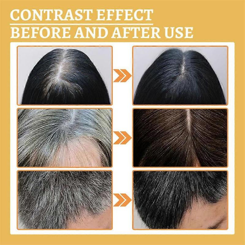 3pcs New Anti-greying Hair Serums Ganoderma Nutrient Hair Darkening Serums Anti Grey Hair Essence For Regrow Thicker Fuller