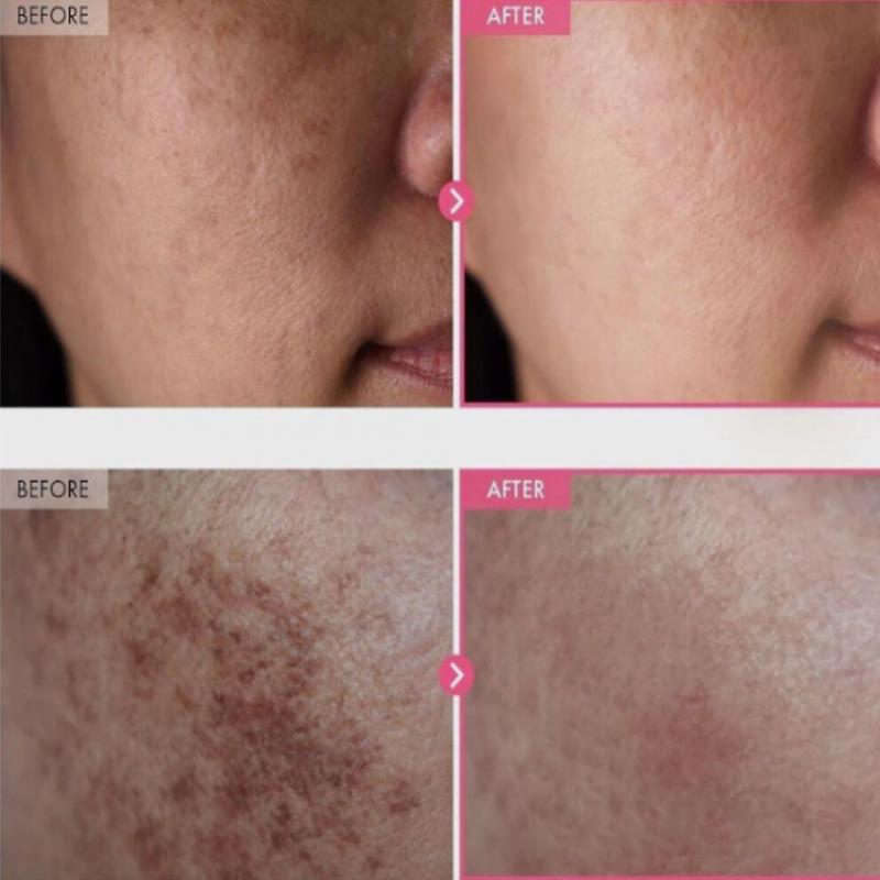 Arbutin 7% Tranexamic Acid 4% Cream 50ml Brightening K-Beauty 50g