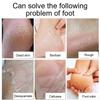 La più recente crema idratante riparatrice per la pelle delle mani e dei piedi anti-screpolature per piedi screpolati, secchi e screpolati, crema per i piedi riparatrice del tallone