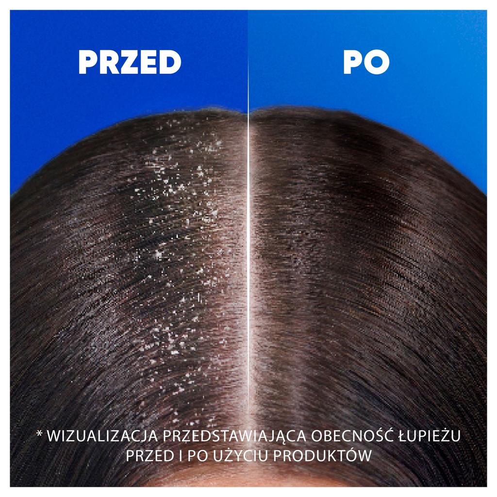 Head & Shoulders Apple Fresh Anti-Dandruff Shampoo 400