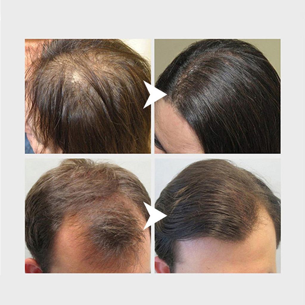 Rice Water Hair Care Serum, Hair Growth Rice Water, Reduce Hair Loss, Hair Loss, Hair Care Serum,30ML