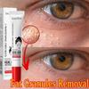 Krem pod oczy Fat Granules Remover Eye Cream Repair Barrier Firm Cream, nawilżający krem przeciwstarzeniowy pod oczy, redukcja cieni pod oczami i opuchlizny Pielęgnacja oczu