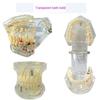 Dental Implant Teaching Model & Toothbrush Preparation Resin Mold