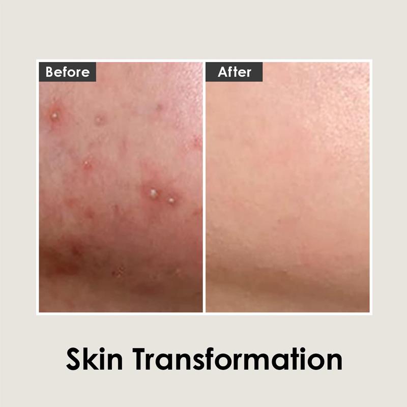 [MEDI-PEEL] Cica Antio Cream 30ml