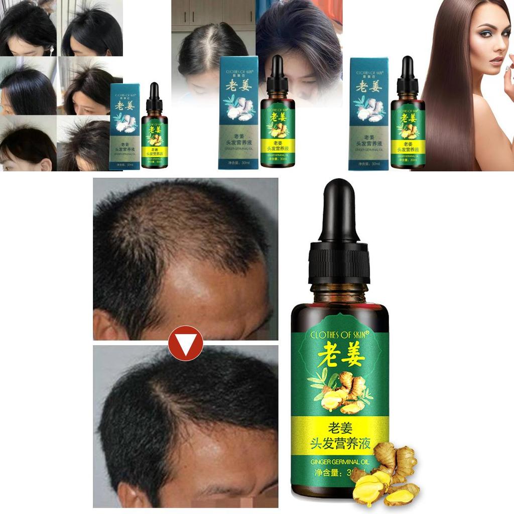 Nourishing Ginger Hair Essence For Healthy And Shiny Locks With Oil Control Benefits