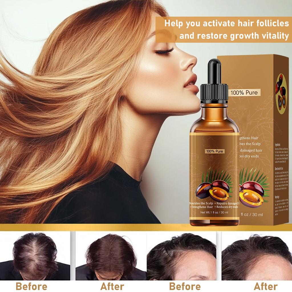 Batana Hair Growth Oil -  Natural Hair Growth Oil, Nourishes The Scalp, Eliminates Split Ends, Detoxifies The Scalp Suitable For All Hair Types 30ml