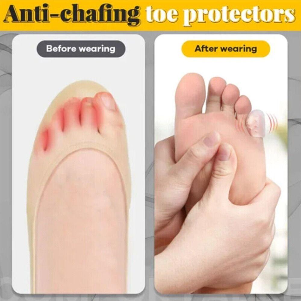 20/10PCs Toe Protector Soft Silicone Breathable Foot Corns Blisters Toe Cap Cover Foot Care Tool Anti-Friction Toe Separators