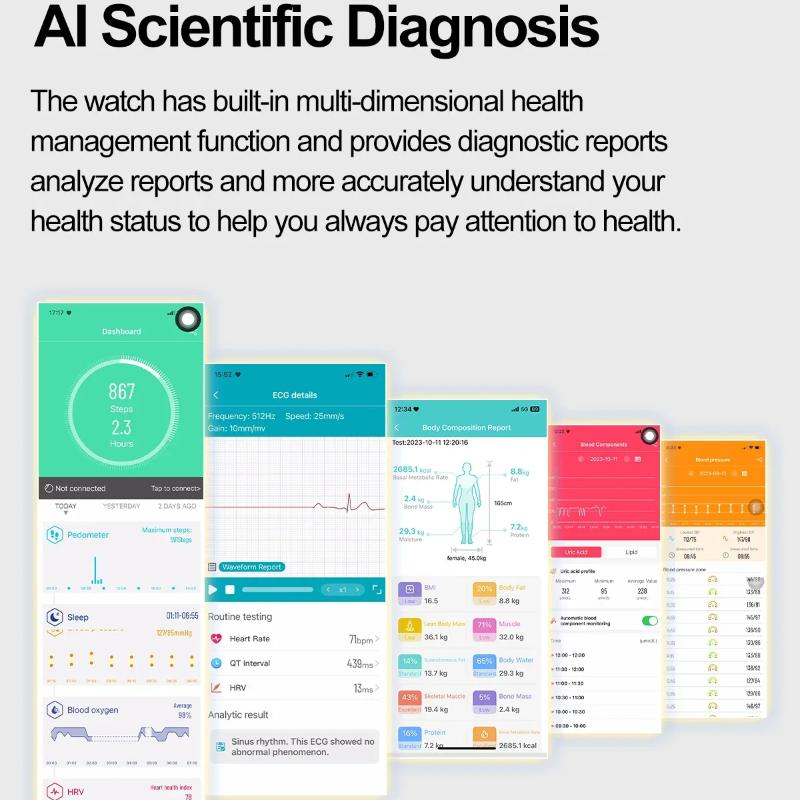 2025 Nowy Smartwatch do Zarządzania Zdrowiem Mężczyźni EKG+PPG Lipid Kwasu Moczowego Monitor Fitness Połączenia Bluetooth Smart Watch