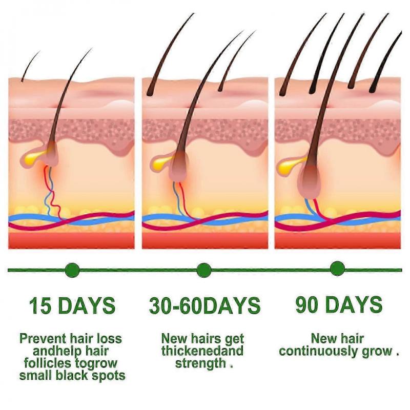 3pcs 30ml Rosemary Hair Growth Oil for Hair Growth & Skin Care,Nourishes Scalp,Rid of Itchy and Dry Scalp for All Hair Types