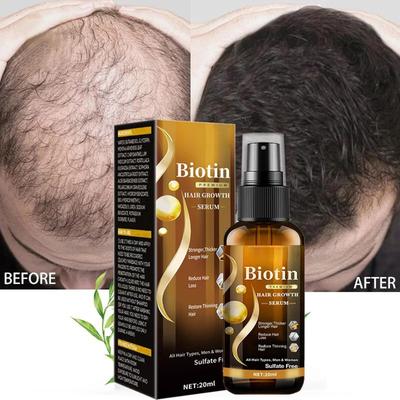 Hair Care Solution, Biotin Hair Growth Spray, Thickening Herbal Serum, For All Hair Types (20ml)