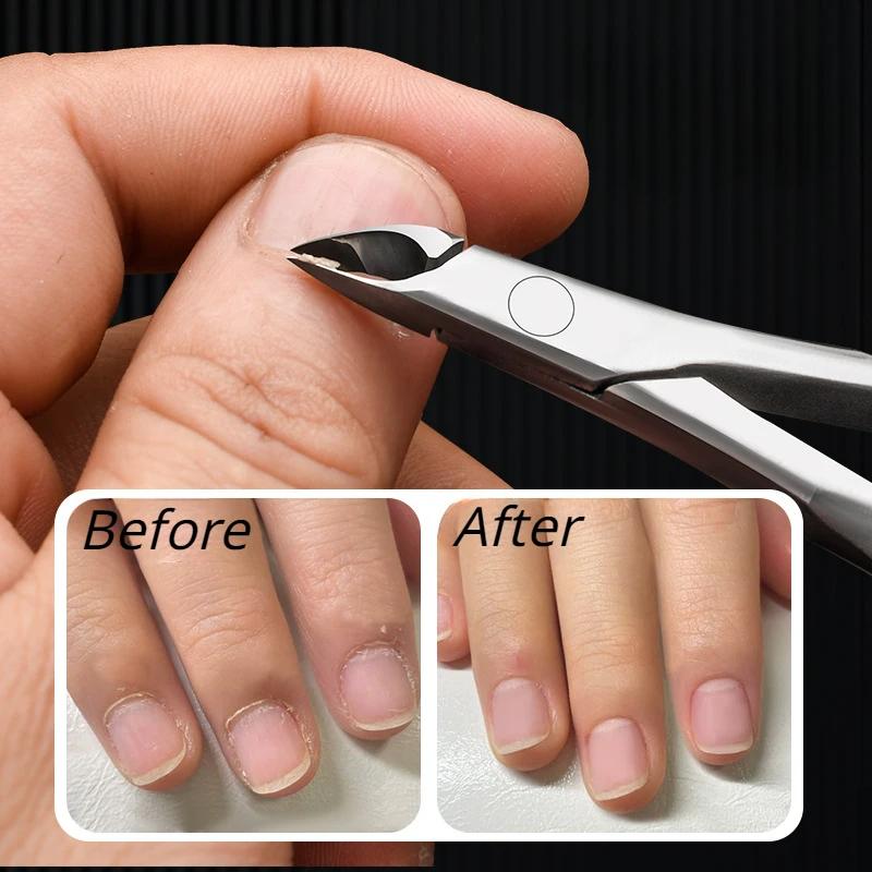 2/4PCS Stainless Steel Cuticle Trimmer Professional Nail Nipper Cuticle Remover for Fingernails  Toenails Dead Skin Nail Cutter