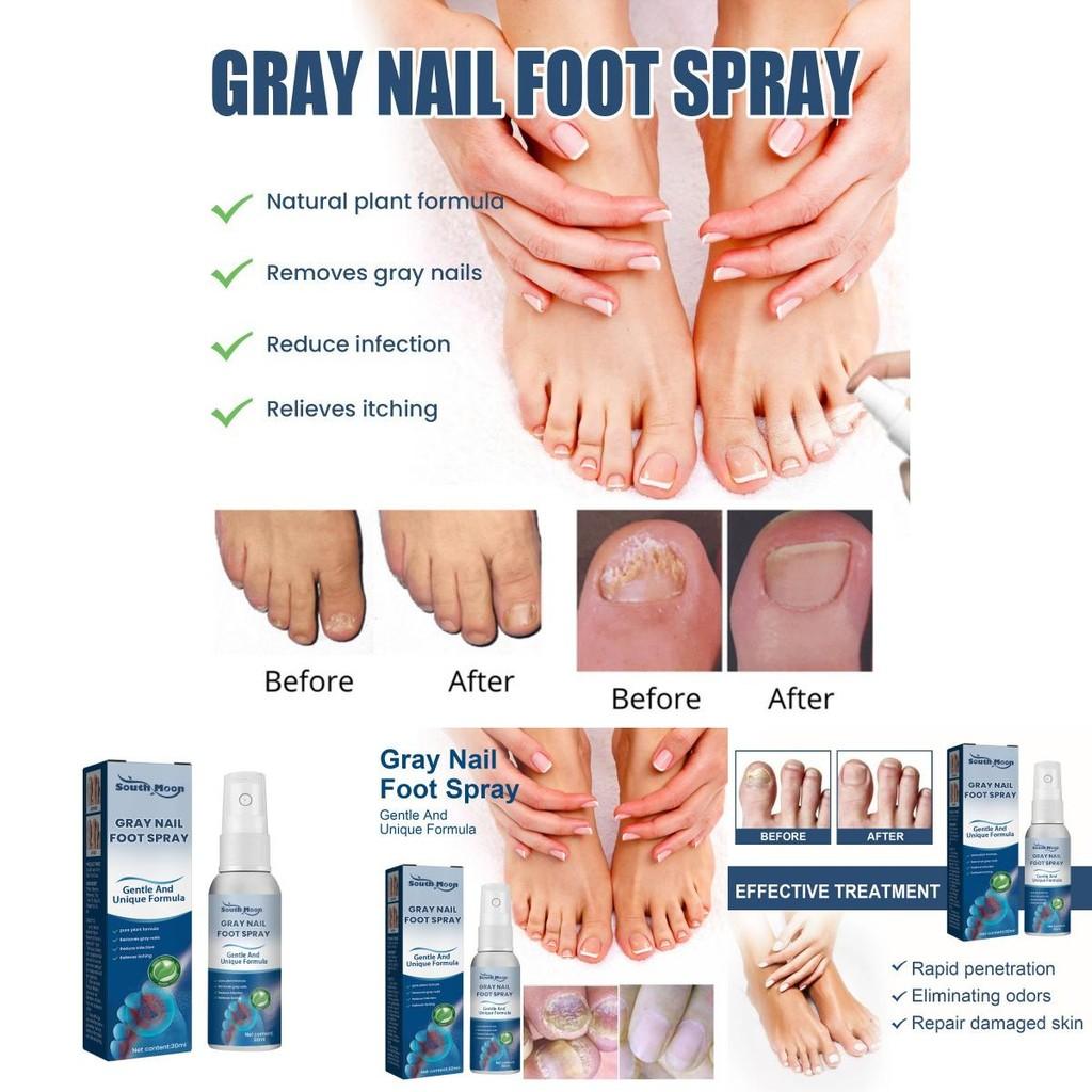 South Moon Gray Nail Repair Spray Nourishing Moisturizing Treatment For Dry And Odorous Nails