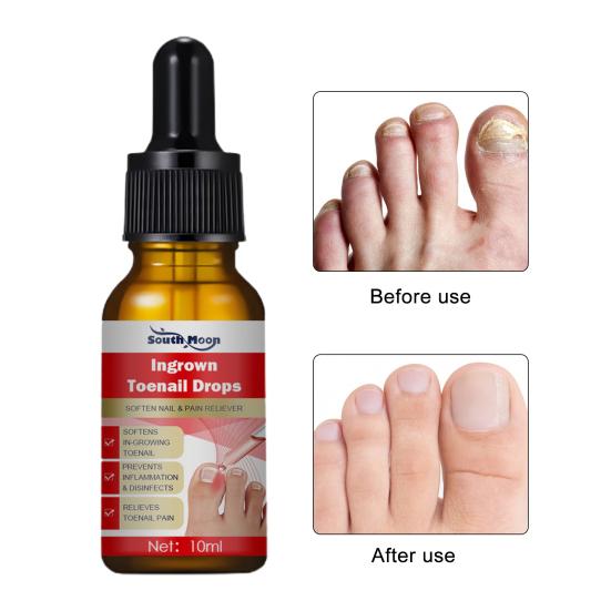 10ml Nail Essence Fast Absorption Protect Painless Reduce Dry Quick Effect Onychomycosis Heal Pedicure Care Nail Fungus Treatment Feet Care Essence