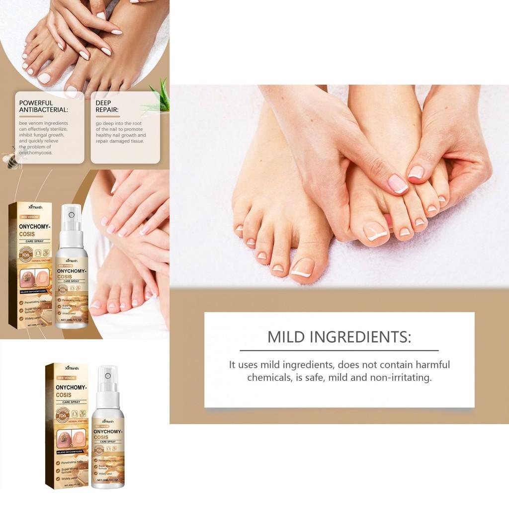 Ximonth Nail Care Spray For Repairing And Strengthening Weak Nails With Gentle Cleansing Properties For Healthy Manicure And Pedicure