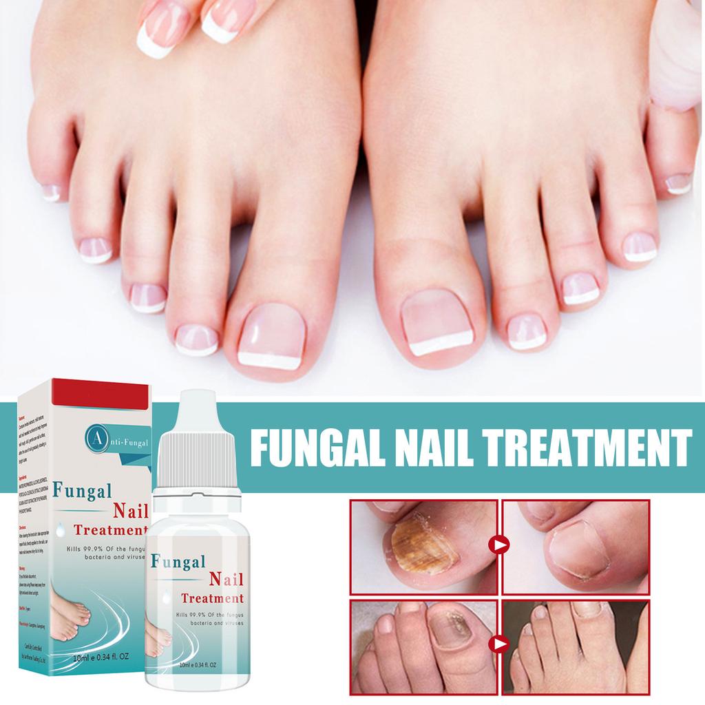 Nail Care Solution, Nail And Toe Care Solution, For Skin Care Nail Nourishing, Fungal Nail Liquid 10ml
