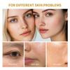1pc Turmeric Peel-Off Pore Refining Face Mask | Blackhead Removal, Exfoliation, Deep Cleansing - Ant