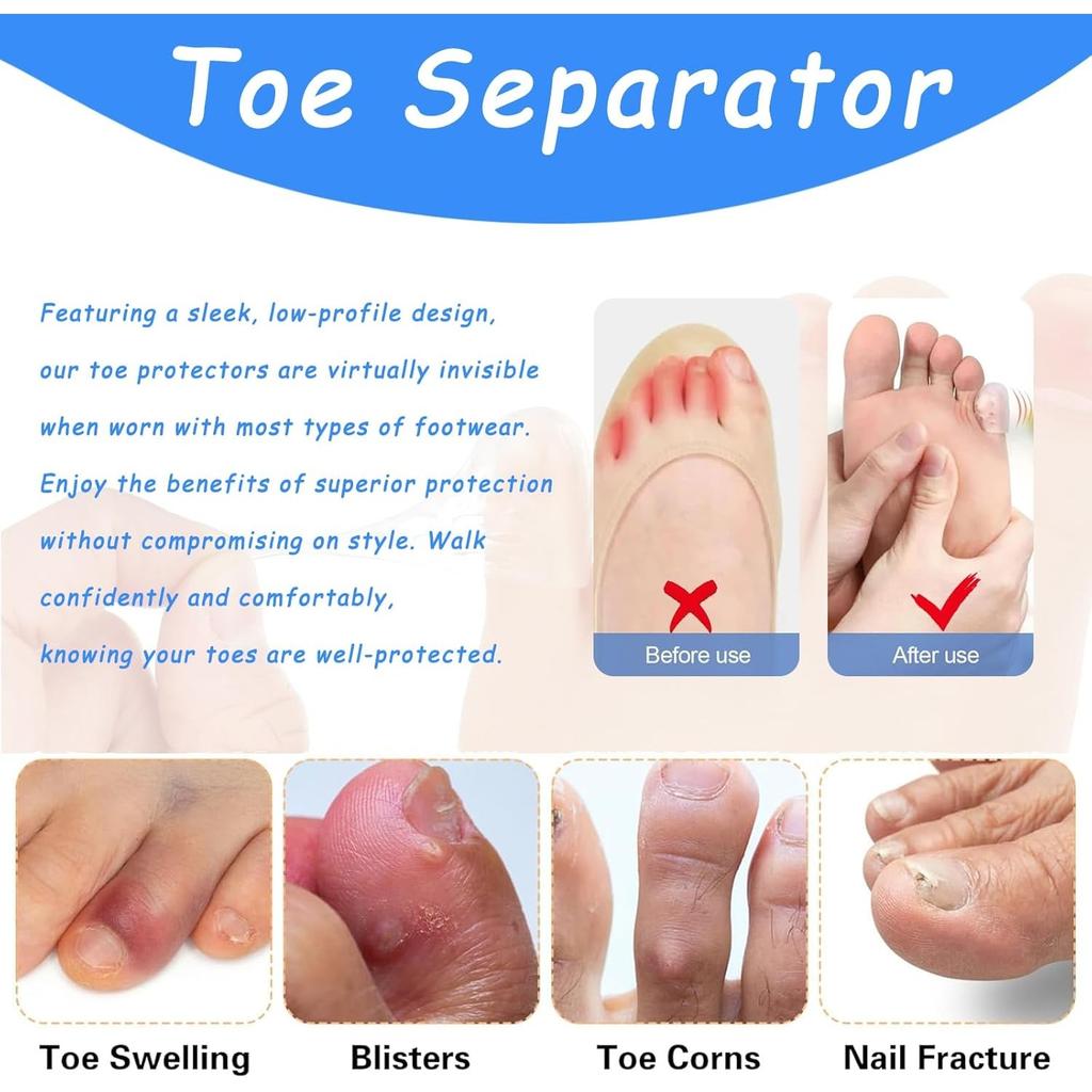Silicone Anti-Friction Toe Protector, Silicone Toe Protectors, Gel Toe Protectors, Breathable Little Toe Covers, Blisters, Calluses, and Corns