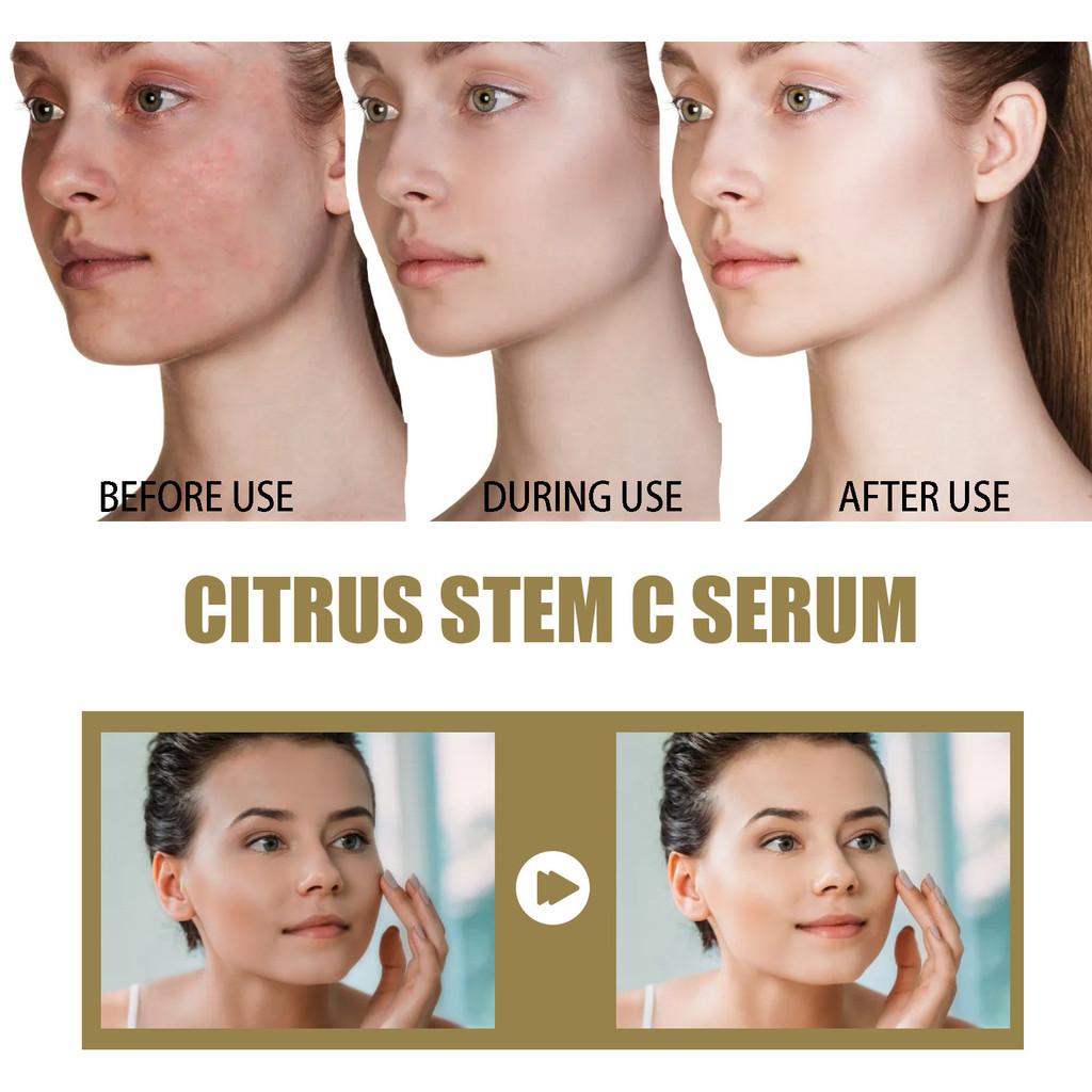 Hoygi Citrusy Facial Essence For Youthful Skin Reducing Wrinkles And Improving Elasticity