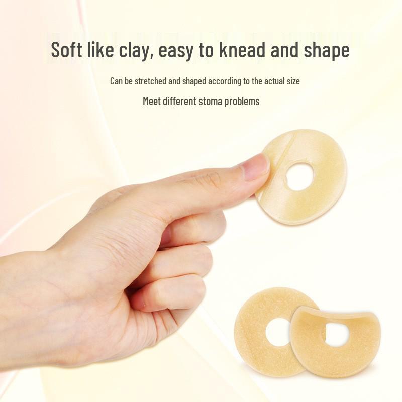 Anneau adhésif moulable étanche pour les soins de stomie - Plaque de base pour accessoire de colostomie