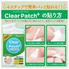 Angelab CICA Tea Tree Clear Patches 48 Patches + (/)
