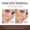 Spots Peel Off Facial Mask Freckle Pigmentation Removal Cream Chloasma Care Dark Spot Correction Glow Whiten Peeling Mask Strong