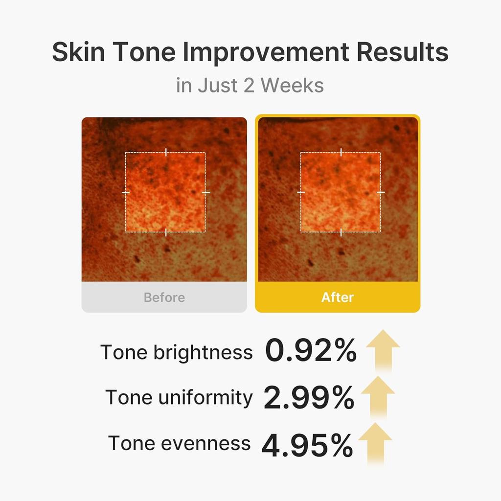 Medicube Capsule Cream Contains Kojic Acid and Turmeric, for Uneven Skin Tone | Repairs Damaged Skin