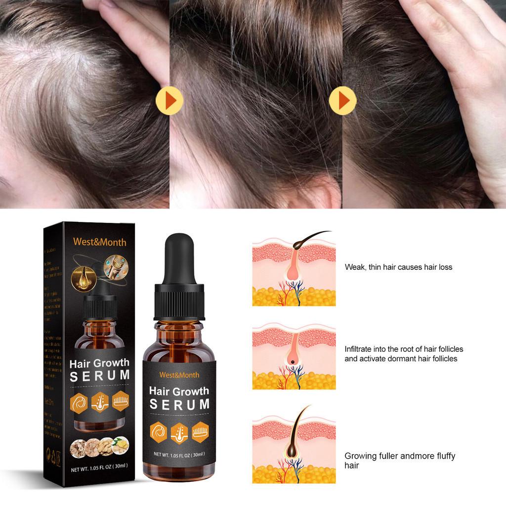 West Month Hair Growth Nutrient Oil For Lush And Thick Hair Nourishing Care 30ml