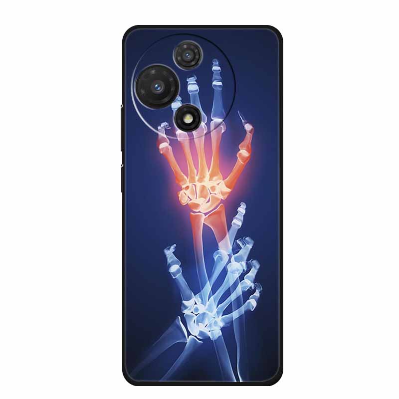 For TCL 605 Case Fashion Flower Protective Black Silicone Soft TPU Back Cover Case For TCL 60 5G 60 SE Case 60SE Coque Funda Bag