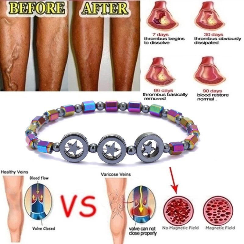 Kolorowe hematytowe magnesy energetyczne bransoletka Anklet kobiety kolorowy kamień terapia magnetyczna bransoletka opieki zdrowotnej urok biżuterii