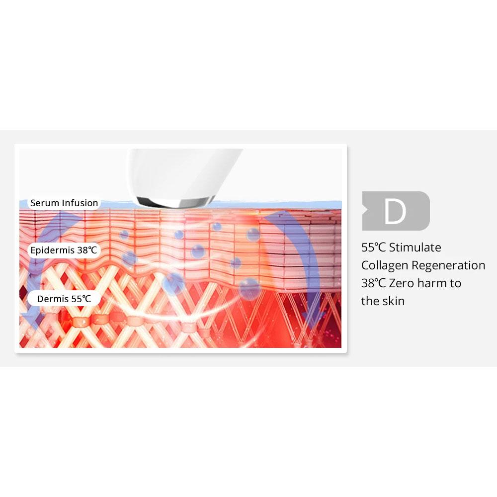 Gesicht Anti-Aging Hautpflege Hautverjüngung Mit Mini Tragbarem Radiofrequenz RF Gerät 1 Sonde Persönlicher Benutzer Für Heimgebrauch