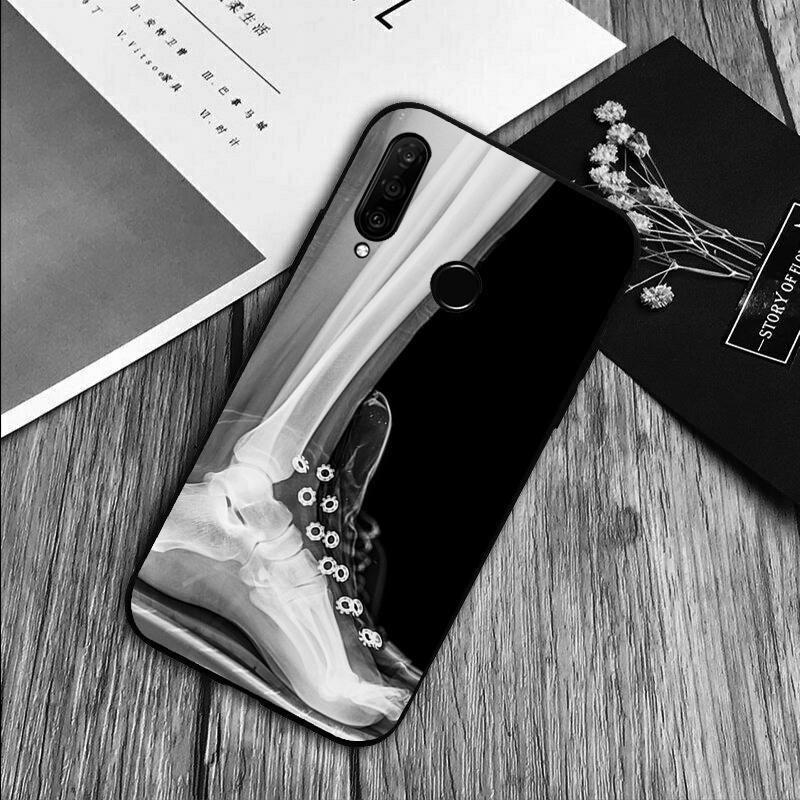 

X-Ray Human Anatomy For Huawei Nova 5T 9 10 SE 7i 8i 11i 12i Y73 Y90 Y70 Y72 Y61 Y91 P60 Pro P40 P30 Lite Case Huawei Nova Y91