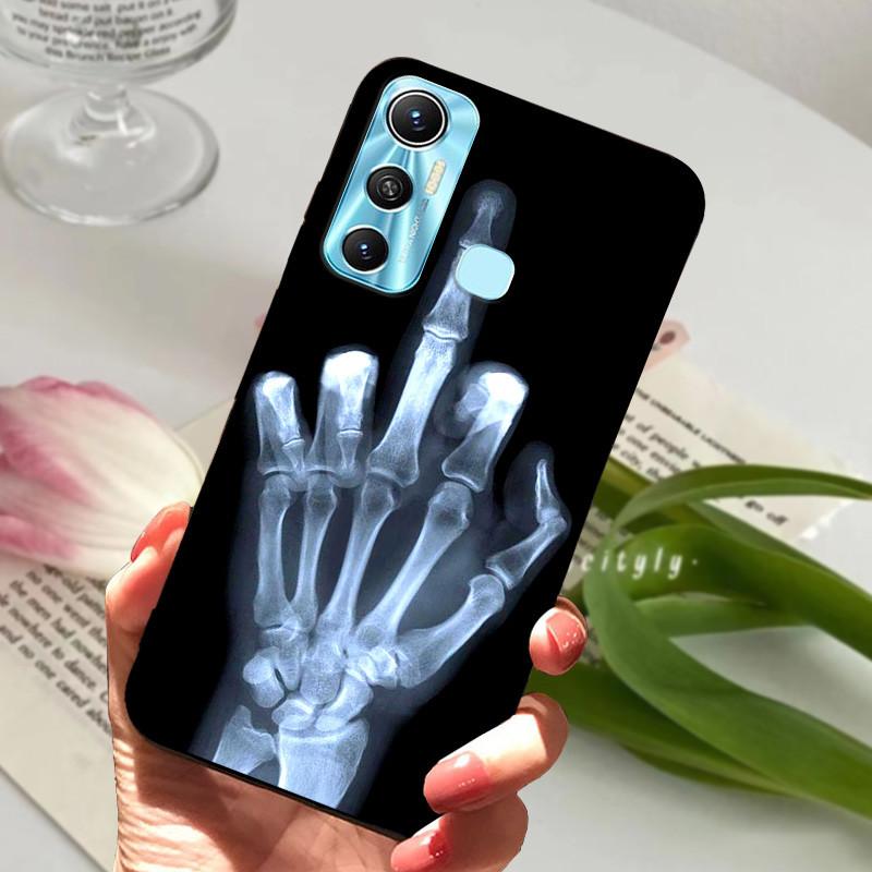 Für Infinix Hot 11 Hülle Coole Mode Wolf Hülle Weiche Silikon Handyhülle Für Infinix Hot 11 Hot11 X662 X662B X689F Hülle Bumper