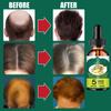 Liquide anti-chute de cheveux pour hommes et femmes Huile essentielle raffermissante pour les cheveux Essence nourrissante réparatrice pour les cheveux Liquide de croissance des cheveux