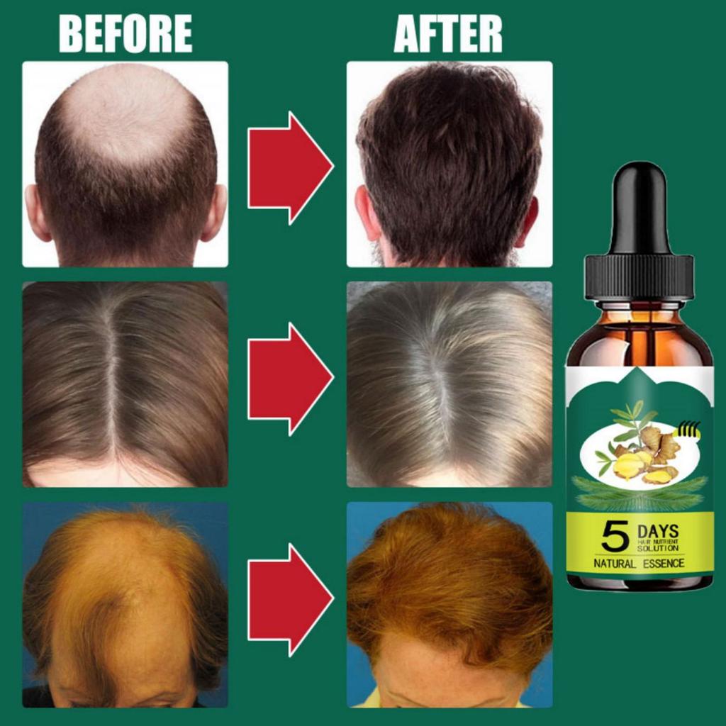 Liquide anti-chute de cheveux pour hommes et femmes Huile essentielle raffermissante pour les cheveux Essence nourrissante réparatrice pour les cheveux Liquide de croissance des cheveux