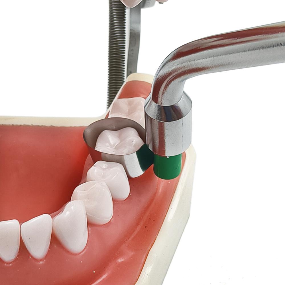 Fialová dentální super mat / Super cap matricový systém nástroj Adapt Super cap matrice držák Univerzální matricová napínací rukojeť nástroje