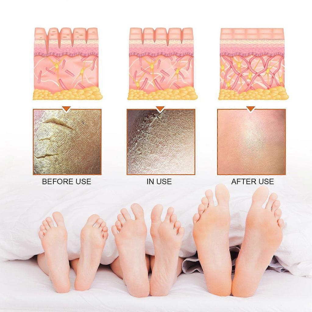 Jaysuing Exfoliating Care Spray Deep Cleansing Exfoliating Dead Skin Whitening Tender Skin Spray
