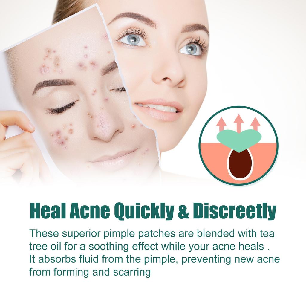 Love Acne Patch Gentle Cleansing Acne Patch To Fade Facial Acne Marks and Spots Facial Cleansing Care
