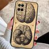 Human Heart Anatomy Case For OPPO A72 A52 A54S A57S A17 A77 A74 A94 A5 A9 A53 A15 A16 A76 A96 A18 A58 A78 A98