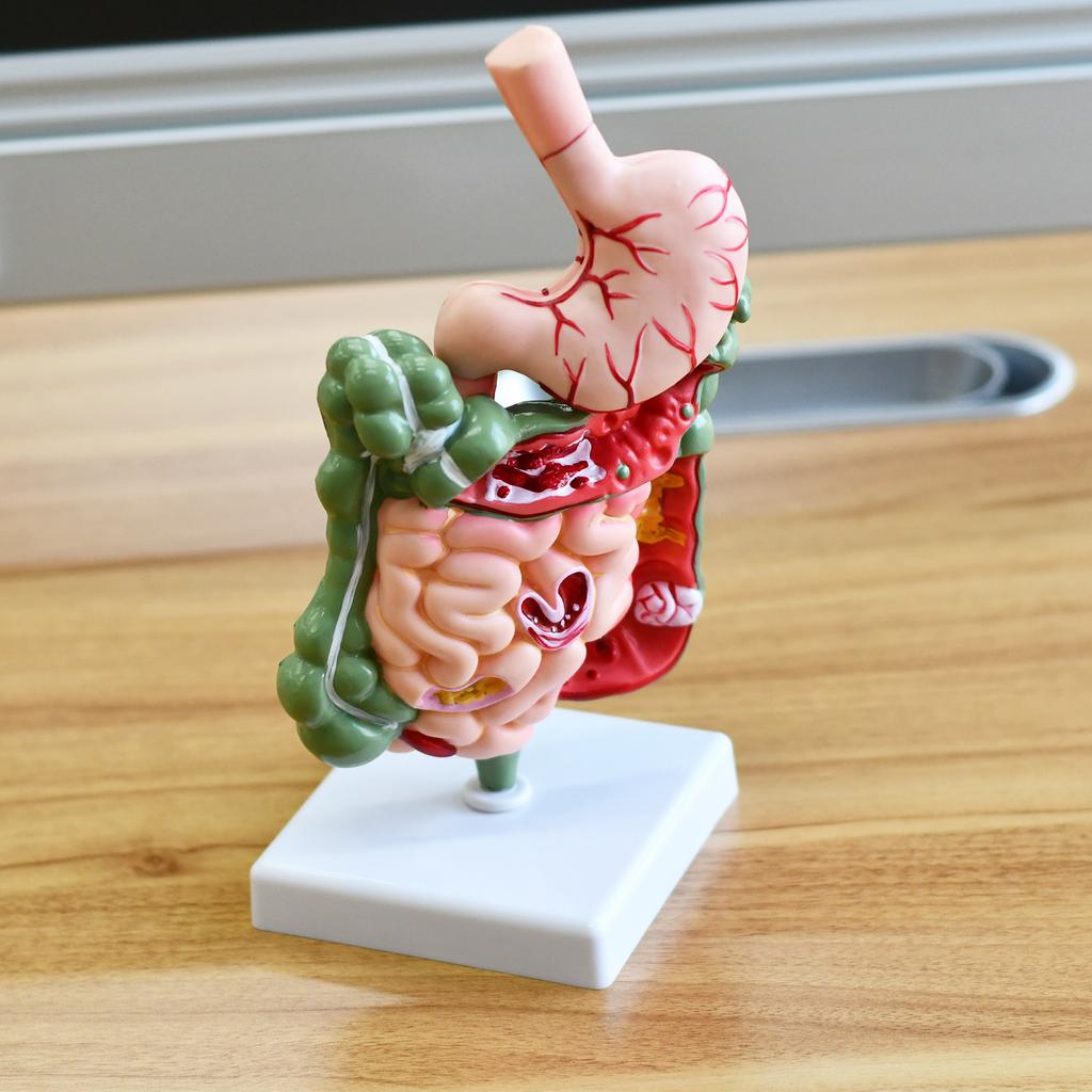 Human Digestive System Model Stomach Anatomy Large Intestine Cecum Rectum Duodenum Human Internal Organs Structure Model